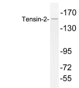 Western blot analysis of lysates from HepG2 cells using Anti-Tensin-2 Antibody