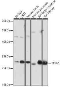 Western blot analysis of extracts of various cell lines, using Anti-OSR2 Antibody (A306208) at 1:1,000 dilution. The secondary antibody was Goat Anti-Rabbit IgG H&L Antibody (HRP) at 1:10,000 dilution.