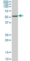 Anti-ALDH6A1 Mouse Polyclonal Antibody