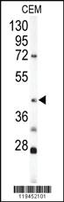 Anti-KRT19 Rabbit Polyclonal Antibody