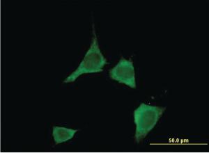 Anti-CAMK2D Mouse Monoclonal Antibody [clone: 1A8]