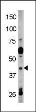 Anti-RAD9A Rabbit Polyclonal Antibody (PE (Phycoerythrin))