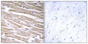 Immunohistochemical analysis of paraffin-embedded human heart tissue using Anti-B3GALT2 Antibody. The right hand panel represents a negative control, where the antibody was pre-incubated with the immunising peptide