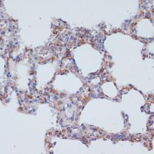 Immunohistochemistry analysis of paraffin-embedded rat lung using Anti-CD40 Antibody (A305284) at a dilution of 1:200 (40X lens). Perform microwave antigen retrieval with 10 mM PBS buffer pH 7.2 before commencing with IHC staining protocol