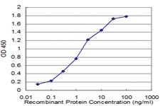 Anti-FMR1 Mouse Monoclonal Antibody [clone: 3E11]