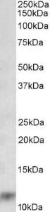 Anti-S100A8 Antibody (A85038) (003 µg/ml) staining of Human Lung lysate (35 µg protein in RIPA buffer) Primary incubation was 1 hour Detected by chemiluminescence