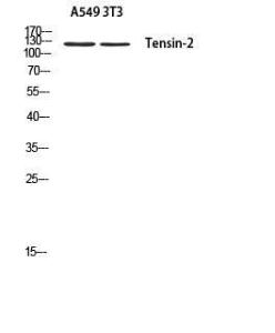 Western blot analysis of A549 3T3 using Anti-Tensin-2 Antibody