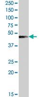 Anti-TMPRSS3 Goat Polyclonal Antibody