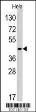 Anti-RAD9A Rabbit Polyclonal Antibody (AP (Alkaline Phosphatase))