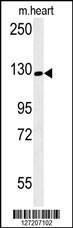 Anti-RGS22 Rabbit Polyclonal Antibody (FITC (Fluorescein Isothiocyanate))