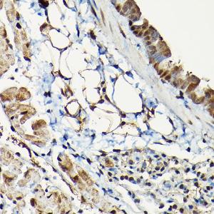 Immunohistochemistry analysis of paraffin-embedded mouse lung using Anti-Smad2 Antibody (A93131) at a dilution of 1:100 (40X lens). Perform high pressure antigen retrieval with 10 mM citrate buffer pH 6.0 before commencing with IHC staining protocol