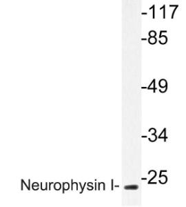 Western blot analysis of lysate from K562 cells using Anti-Neurophysin I Antibody