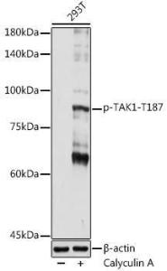 Anti-TAK1 (phospho Thr187) Rabbit Antibody