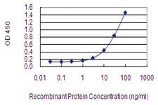 Anti-AFF2 Mouse Monoclonal Antibody [clone: 4D11]