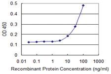 Anti-NR1H3 Mouse Monoclonal Antibody [clone: 3E9]