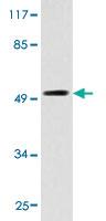 Anti-OPN4 Rabbit Polyclonal Antibody