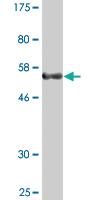 Anti-SERTAD1 Mouse Monoclonal Antibody [clone: 3H4]