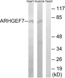 Western blot analysis of lysates from rat muscle and rat heart cells using Anti-ARHGEF7 Antibody. The right hand lane represents a negative control, where the antibody is blocked by the immunising peptide