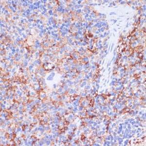 Immunohistochemistry analysis of paraffin-embedded rat spleen using Anti-CD40 Antibody (A305284) at a dilution of 1:200 (40X lens). Perform microwave antigen retrieval with 10 mM PBS buffer pH 7.2 before commencing with IHC staining protocol