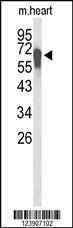 Anti-KCNA3 Rabbit Polyclonal Antibody