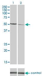 Anti-CAMK2D Mouse Monoclonal Antibody [clone: 1A8]