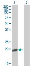 Anti-FN1 Mouse Polyclonal Antibody