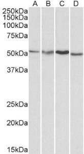 Anti-AKT3 Antibody (A83410) (1µg/ml) staining of HepG2 (A), Jurkat (B), Mouse Brain (C) and Rat Brain (D) lysates (35µg protein in RIPA buffer). Primary incubation was 1 hour. Detected by chemiluminescence.