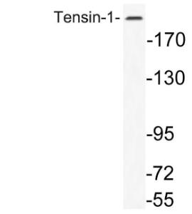 Western blot analysis of lysate from K562 cells using Anti-Tensin-1 Antibody