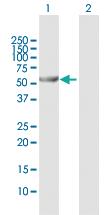 Anti-ALDH6A1 Rabbit Polyclonal Antibody