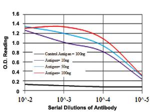 Anti-NQO1 Mouse Monoclonal Antibody [clone: 1A11]