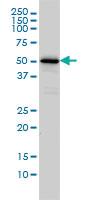 Anti-CAMKK1 Mouse Monoclonal Antibody [clone: 1F6]