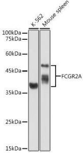 Anti-CD32 antibody