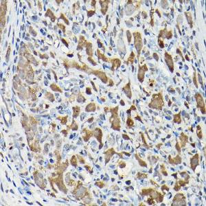 Immunohistochemistry analysis of paraffin-embedded rat ovary using Anti-Smad2 Antibody (A93131) at a dilution of 1:100 (40X lens). Perform high pressure antigen retrieval with 10 mM citrate buffer pH 6.0 before commencing with IHC staining protocol