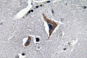 Immunohistochemical analysis of paraffin-embedded human brain tissue using Anti-Neurophysin I Antibody