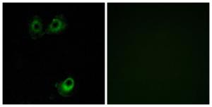 Antibody anti-OR11L1 A99540-100 100 µg