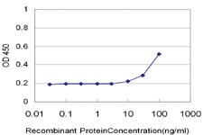 Anti-CAMK2D Mouse Monoclonal Antibody [clone: 1B11]