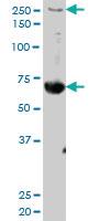 Anti-FN1 Mouse Polyclonal Antibody