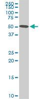 Anti-STK38 Mouse Monoclonal Antibody [clone: 6G11]