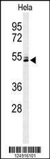 Anti-K2C78 Rabbit Polyclonal Antibody (AP (Alkaline Phosphatase))