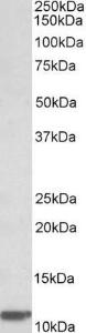 Anti-B2M Antibody (A85040) (0.03 µg/ml) staining of Human Duodenum lysate (35 µg protein in RIPA buffer). Primary incubation was 1 hour. Detected by chemiluminescence