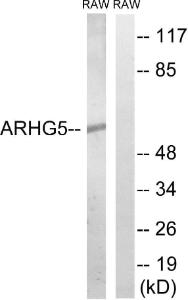 Western blot analysis of lysates from RAW264.7 cells using Anti-ARHGEF5 Antibody. The right hand lane represents a negative control, where the antibody is blocked by the immunising peptide