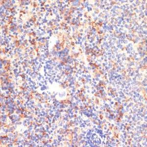 Immunohistochemistry analysis of paraffin-embedded mouse spleen using Anti-CD40 Antibody (A305284) at a dilution of 1:200 (40X lens). Perform microwave antigen retrieval with 10 mM PBS buffer pH 7.2 before commencing with IHC staining protocol