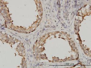 Anti-TUBA4A Mouse Monoclonal Antibody [clone: 2E11]