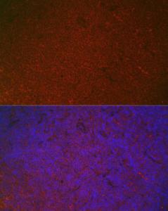 Anti-CD32 antibody