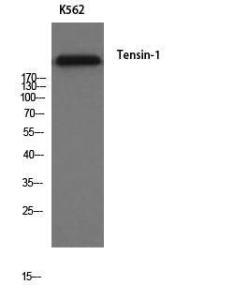 Western blot analysis of K562 cells using Anti-Tensin-1 Antibody