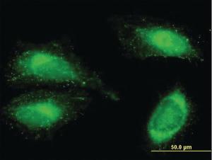 Anti-FN1 Mouse Polyclonal Antibody