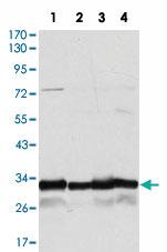 Anti-NQO1 Mouse Monoclonal Antibody [clone: 1A11]