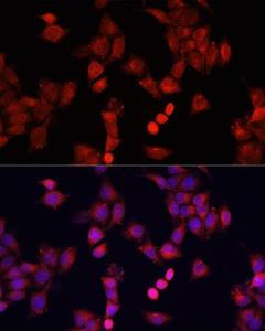 Immunofluorescence analysis of HeLa cells using Anti-Smad2 Antibody (A93131) at a dilution of 1:100. DAPI was used to stain the cell nuclei (blue)