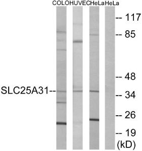 Anti-SLC25A31 antibody