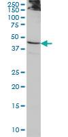 Anti-ACTL7B Mouse Monoclonal Antibody [clone: 6A4]